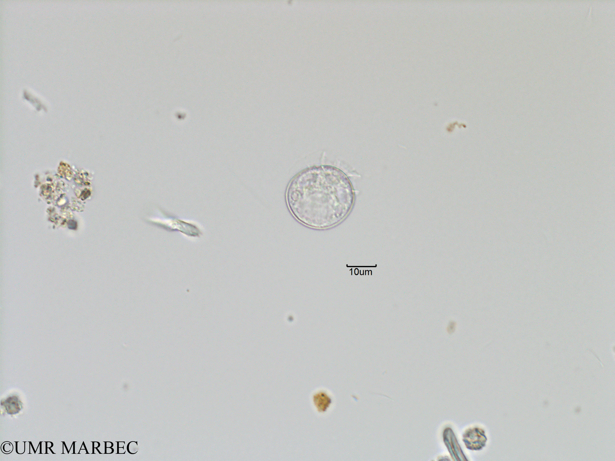 phyto/Bizerte/bizerte_bay/RISCO November 2015/Dinophysis bibulba (Baie_T5-C1-Dinophysis).tif(copy).jpg